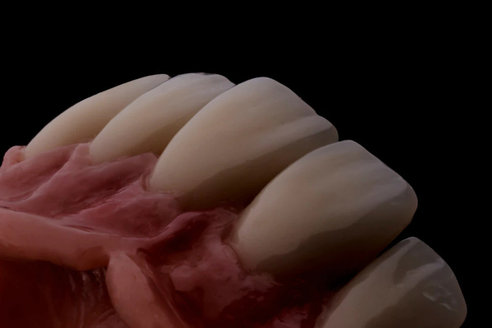 Denture Teeth